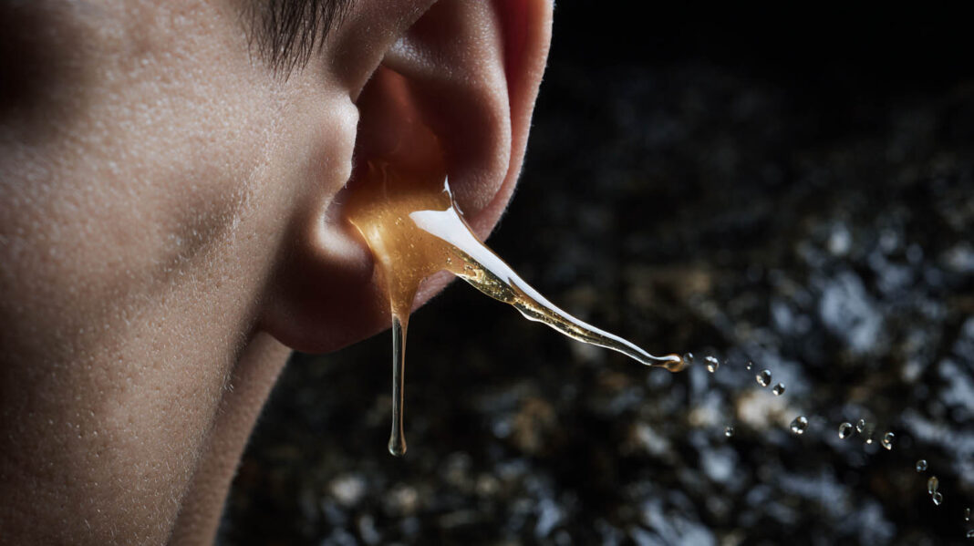 ear wax A river of ear wax coming out of a man's ear.